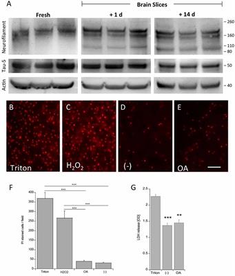 Differential Hyperphosphorylation of Tau-S199, -T231 and -S396 in Organotypic Brain Slices of Alzheimer Mice. A Model to Study Early Tau Hyperphosphorylation Using Okadaic Acid